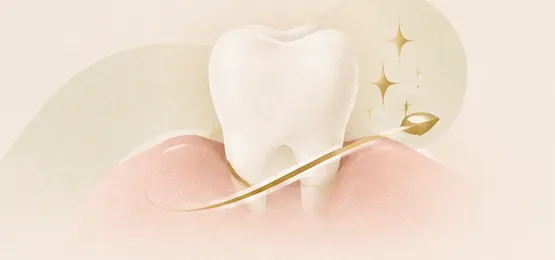 Ilustração de dente sobre gengiva saudável sendo polido